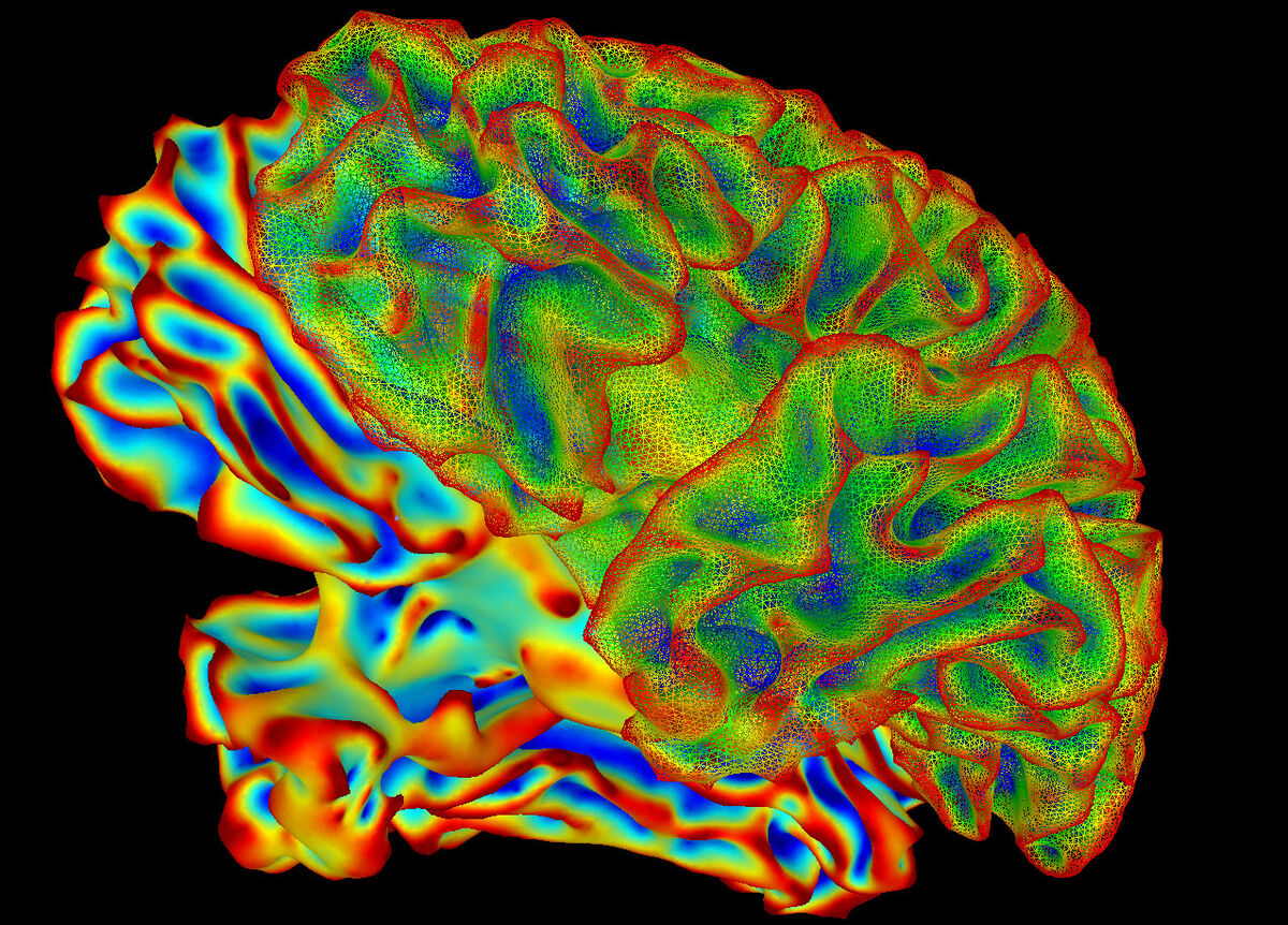 A 3D model of a human brain seen from the side, its folds covered in a fine mesh and colored in bands of green, blue, yellow and red against black.